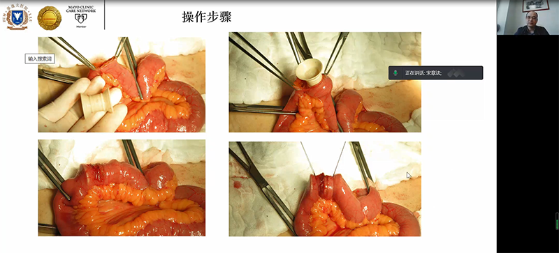 文中照片排序4(宋章法教授3).png 文中照片排序4(宋章法教授3).png